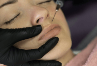 botox injection